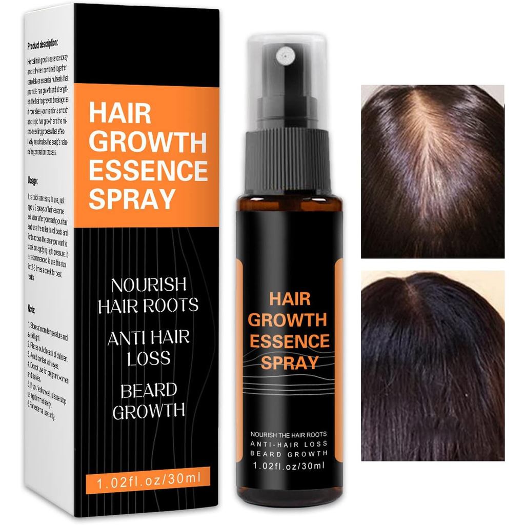 Hair Regrowth Spray,Hair Regrowth Serum Spray,สเปรย์สําหรับป้องกันผมร่วง,Nourishing Ginger Spray for