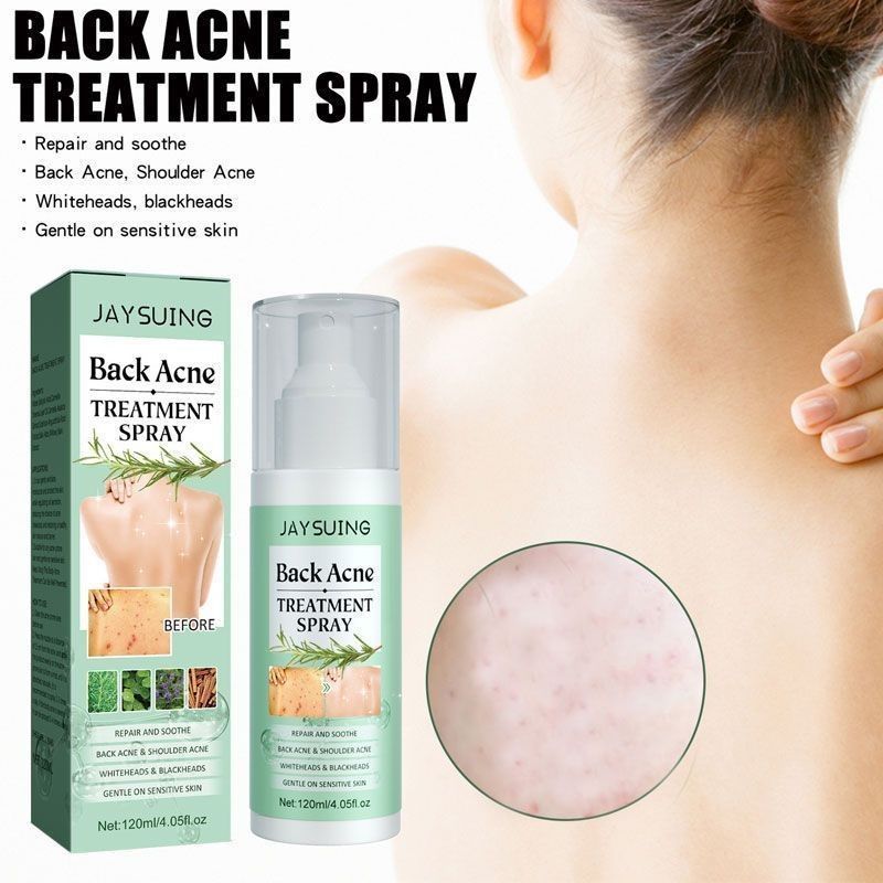 Jaysuing Back Acne Repair Spray Repair Back Shoulder Acne ลดสิวรอยสิว Skin Care Spray yy4.21