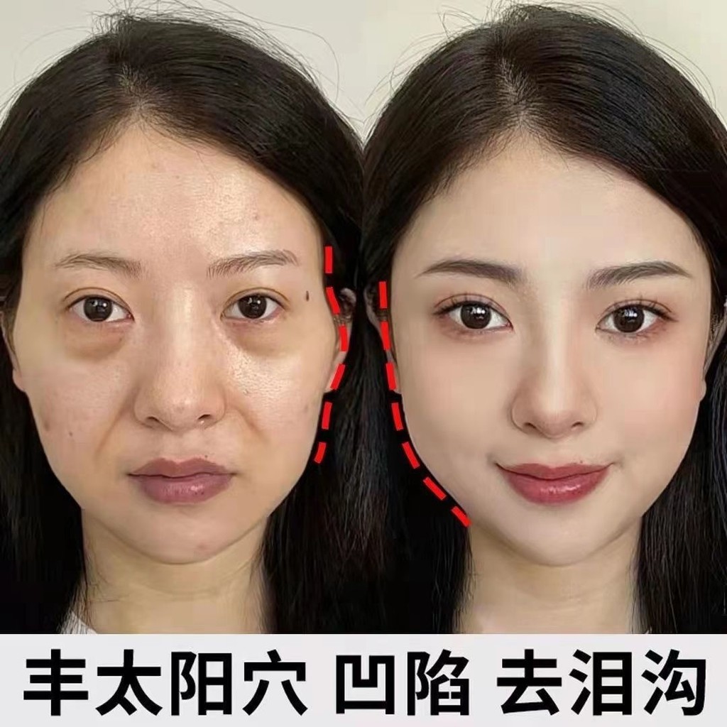 เซรั่มเพิ่มปริมาตรบนใบหน้า Plumping Sun Cave Tear Cave Removal Depression Law Lines อาหารเสริมคอลลาเ
