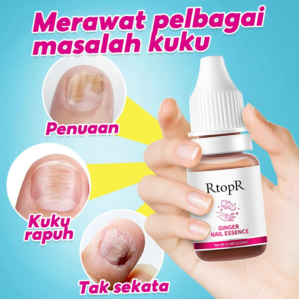 RTOPR RtopRHOTGinger Nail Care Serum / Ginger Nail Care Essence / Nail Care / Anti-Infection / Paron
