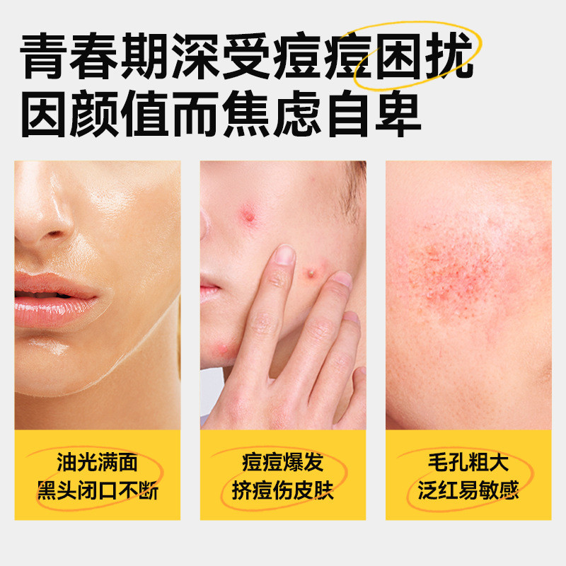 Yu Meijing หน้ากากเยาวชนควบคุมน้ํามันลบชายหญิงวัยรุ่นเฉพาะ Moisturizing Face Patch ผิว 26/4/27 LD3G