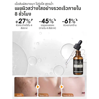 ✨ซื้อ1แถม 3✨เซรั่มบำรุงผิวหน้าไนอะซินาไมด์/ช่วยให้ผิวขาวกระจ่างใส/ลดเลือนจุดด่างดำ/บำรุงผิว/ไนอะซินาไมด์เข้มข้นสูง / ซึมซาบง่าย ไม่มัน/ไม่เหนียวเหนอะหนะ/อ่อนโยน ไม่ระคายเคือง|เหมาะสำหรับผิวหมองคล้ำ/จุดด่างดำ/สีผิวไม่สม่ำเสมอ