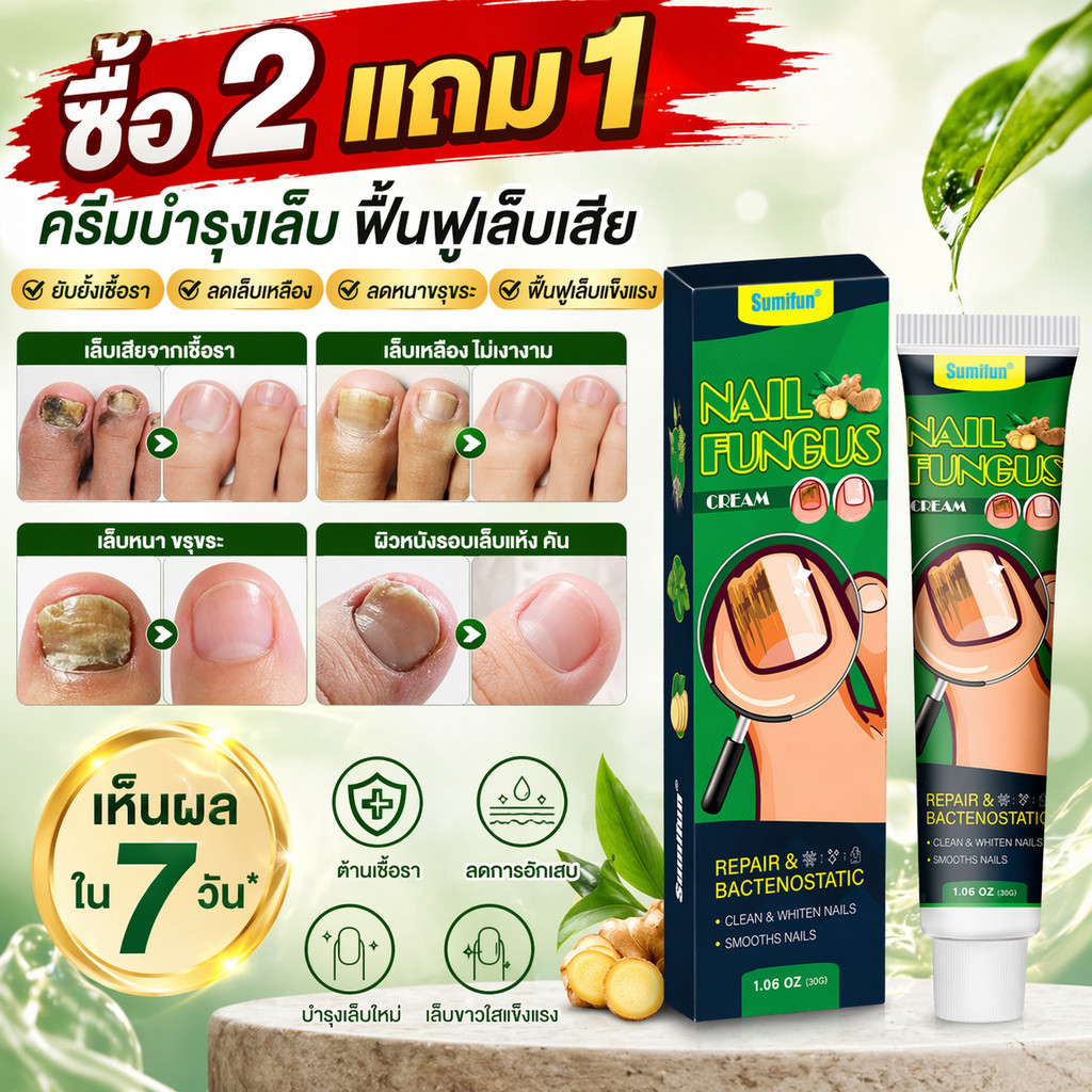 [ซื้อ 2 แถม 1] ครีมบำรุงเล็บ: ซ่อมแซมเล็บที่เสียหาย มีคุณสมบัติต้านเชื้อแบคทีเรีย และช่วยลดอาการเล็บเหลือง