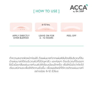 (1ซอง) ACCA By Dr.DSP Pro Acne Mask โปรแอคเน่มาสก์ แอคก้าบายดร.ดีเอสพี 10ชิ้น.