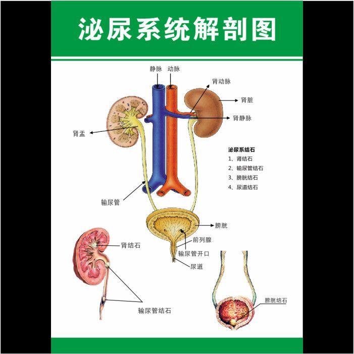 โรงพยาบาลร่างกายมนุษย์ระบบปัสสาวะโครงสร้าง Schematic Diagram โปสเตอร์ระบบปัสสาวะโครงสร้างหินไดอะแกรม