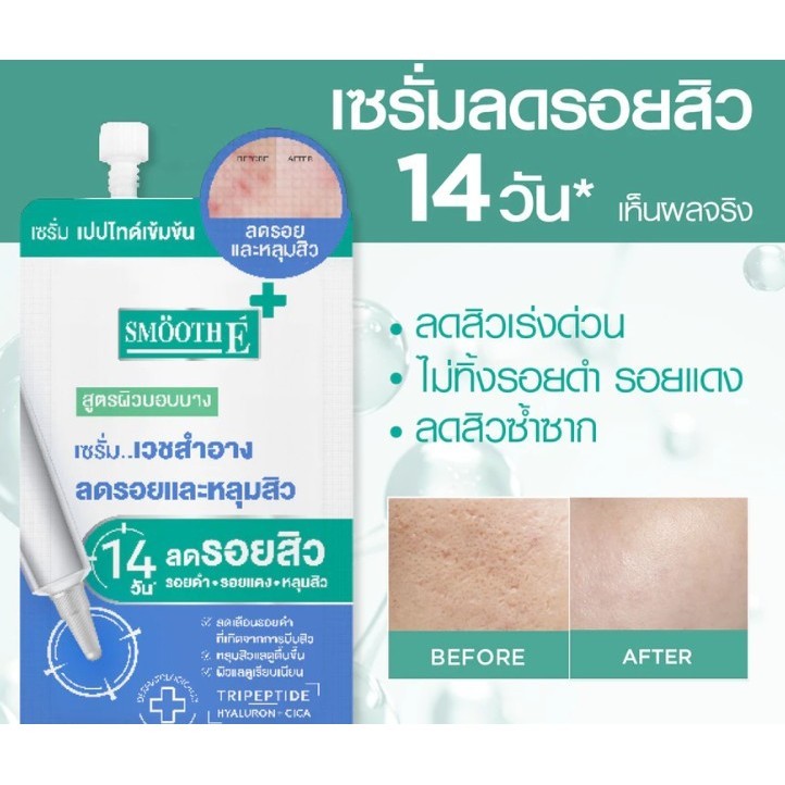 Smooth E Smooth Sca Serum 5g. ลดรอยและหลุมสิว สมูธ อี รูปที่ 2