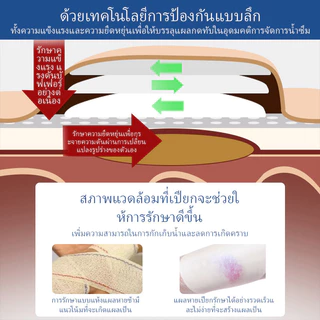 แผ่นป้องกันแผลกดทับสําหรับผู้สูงอายุ✨1 ชิ้น/ 4 ชิ้น กันน้ำและระบายอากาศแผ่นแปะแผลกดทับ ป้องกันการติดเชื้อและลดความเครียด