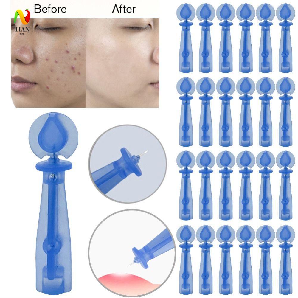 INQUIRY IMPACT 50 ชิ้น/กล่องทิ้งเข็มสิว, Blackhead Remover Pimple Pins Blackhead Remover เครื่องมือ,