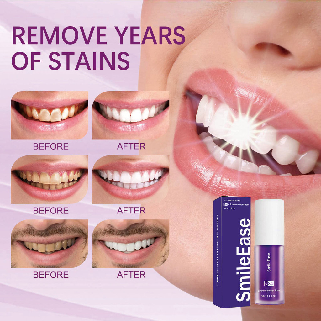 SmileEase v34 colour corrector Purple Tooth Whitening Tooth Stain ยาสีฟันสีม่วง smile kit Against Se