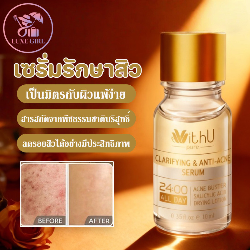LUXE GIRL WithUpure  Anti Acne Lotion ของแท้ ลดรอยสิว สารสกัดจากพืชธรรมชาติ ช่วยลดรูขุมขนและสิ อ่อนโยนต่อผิว