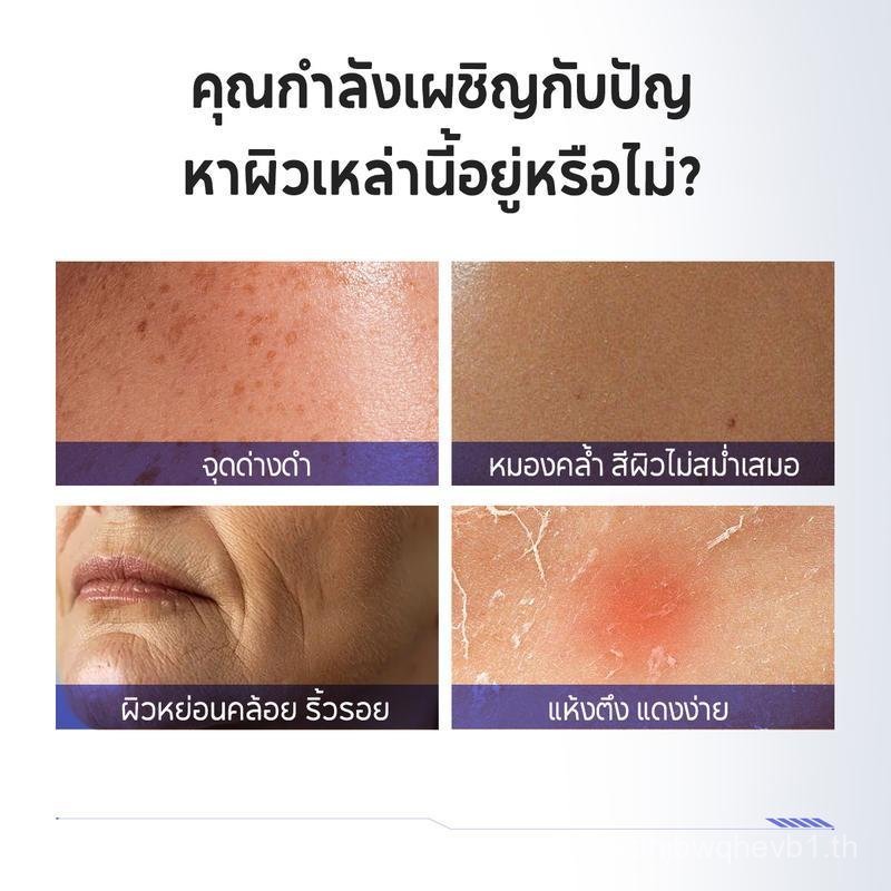 PAPA FEEL [FDA]  577 ครีมจุดด่างดำ 30g + 577 Serum เซรั่ม 30 ml | ผิวแพ้ง่ายใช้ได้ | หมองคล้ำ | ฝ้าก