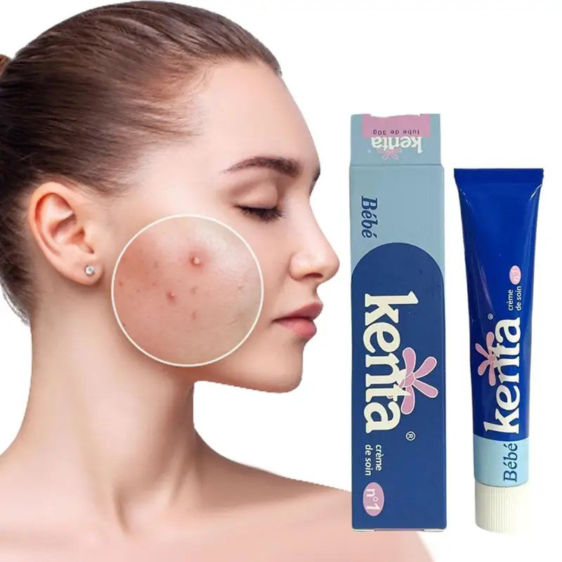 1/3pcs 30g Soothing Moisturizing Cream Bebe Kenta Whiten Fade Fine Lines Blemishes Acne Original ยี่