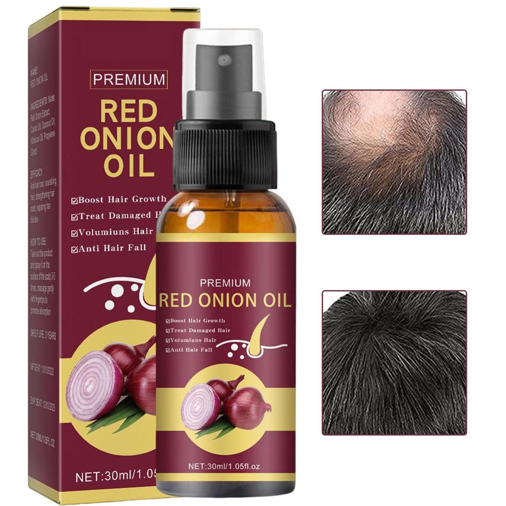 Onion Hair Thickening 30ML Onion Oil Hair Follicle Stimulating Gentle Hair Care Accessories Suitable