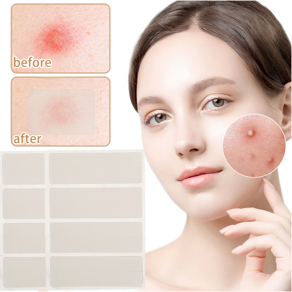 T-Zone Acne Cover Patch สําหรับแต่งหน้า | ไฮโดรเจล สติ๊กเกอร์สิวใส 4 ขนาด, กันน้ําและระบายอากาศได้, 