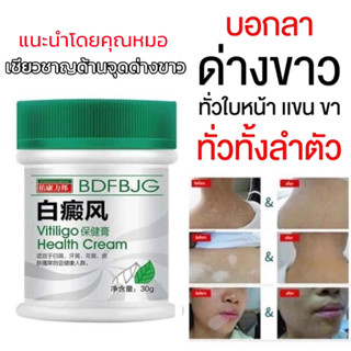 สมุนไพร ด่างขาว เกลื้อนน้ำนม ครีมบํารุงผิวรักษาจุดด่างดํา Vi…
