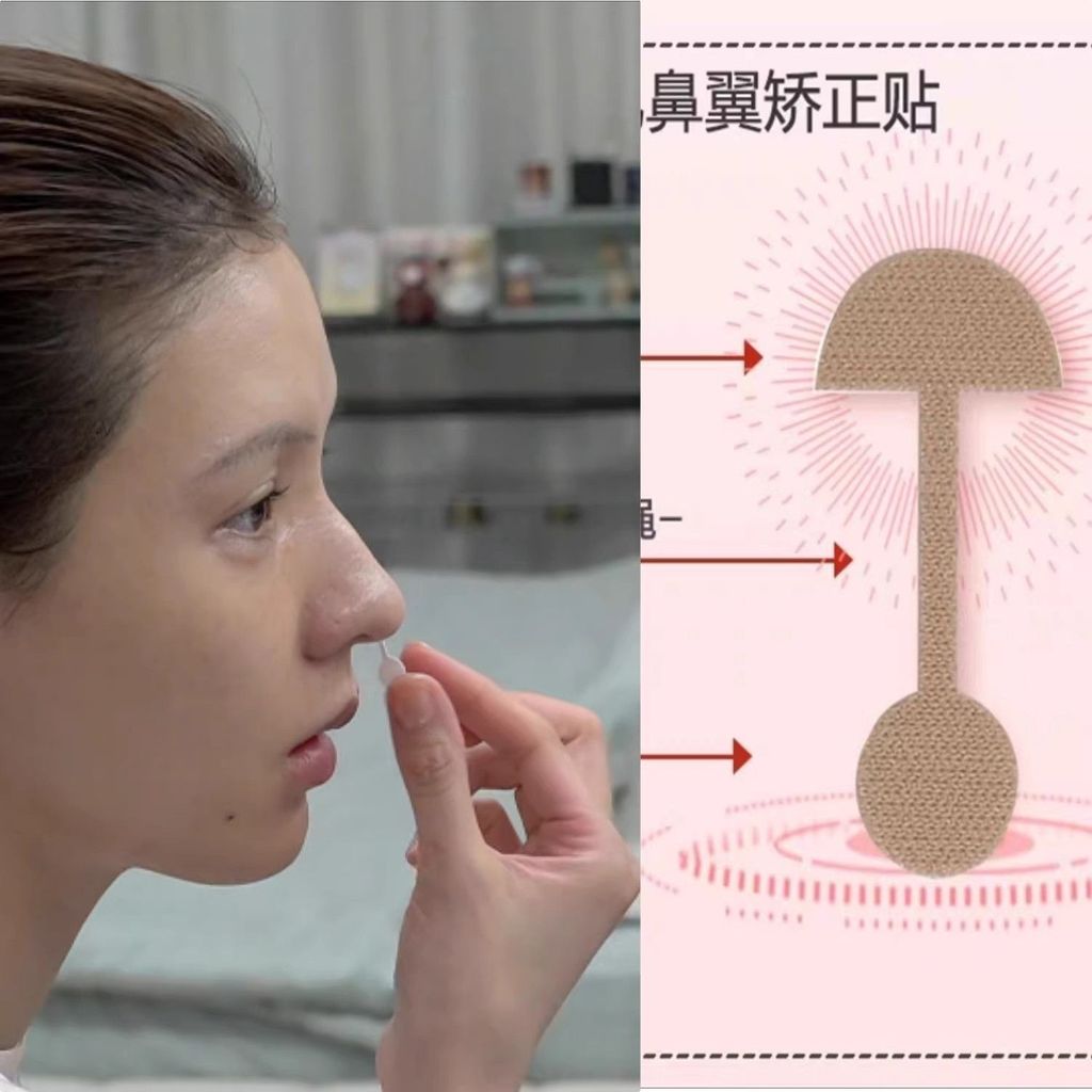 แผ่นแปะจมูก Zhang Yuxi สำหรับปรับรูปทรงปีกจมูกและลดความพวงของจมูก แบบที่มองไม่เห็นขณะนอน