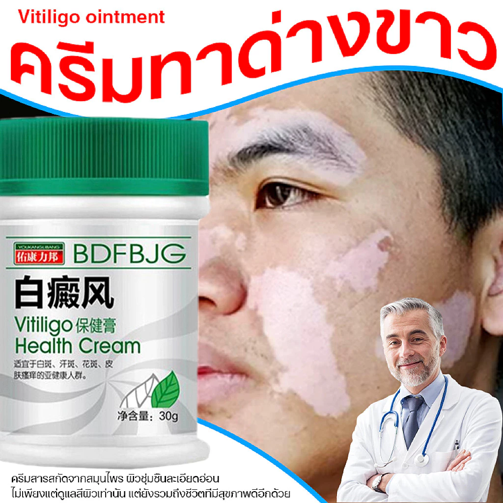 ครีมทาด่างขาว 30gสารสกัดจากสมุนไพร ด่างขาวที่หน้า ด่างขาวที่หลัง ด่างขาวที่แขน ด่างขาวที่ขา โรคผิวหนัง Vitiligo ยาทาด่า