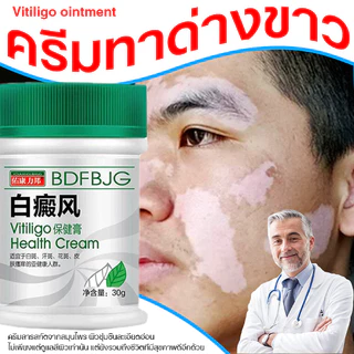 ครีมทาด่างขาว 30gสารสกัดจากสมุนไพร ด่างขาวที่หน้า ด่างขาวที่หลัง ด่างขาวที่แขน ด่างขาวที่ขา โรคผิวหนัง Vitiligo ยาทาด่า