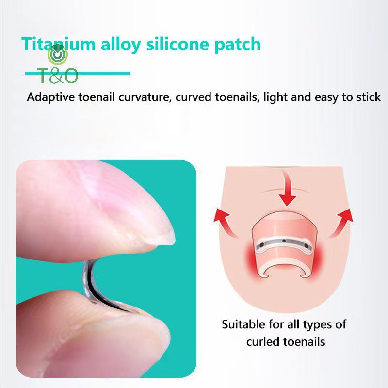 T&O 2 ชิ้นคุด Toenail Corrector เครื่องมือ Pedicure Recovered Toe Nail Professional คุด Toenail Stra
