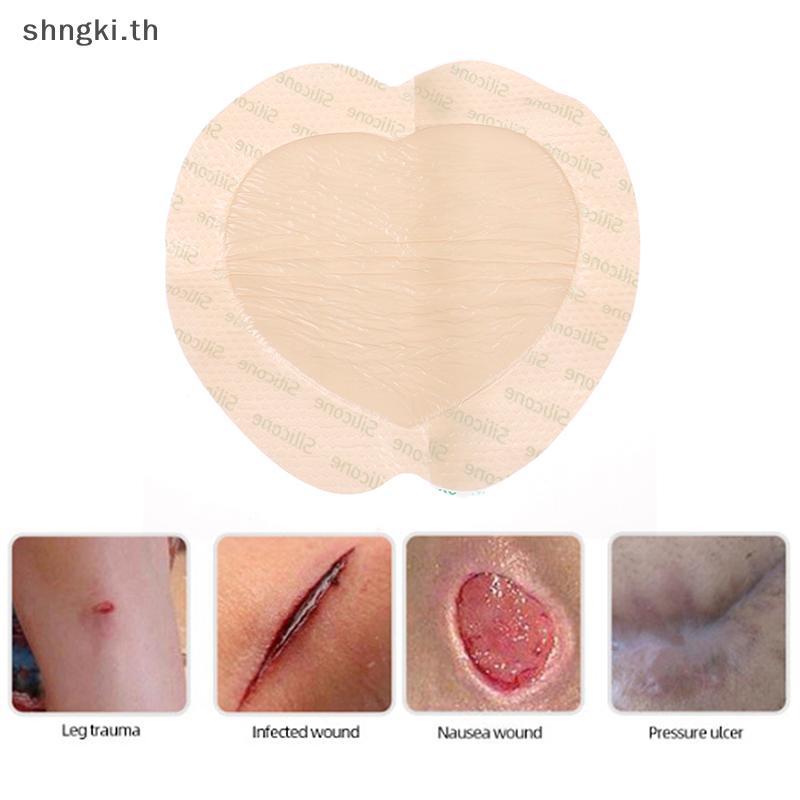 SHNGKI 1 ชิ้นซิลิโคน Wound Patch Bedsore Dressing Patch สําหรับความดัน Ulcer null