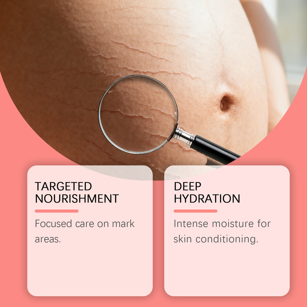 ครีมบํารุงผิว 30g| Even Skin Tone | เหมาะสําหรับทุกสภาพผิว | เนื้อละเอียด การดูดซึมอย่างรวดเร็ว - รูปที่ 4