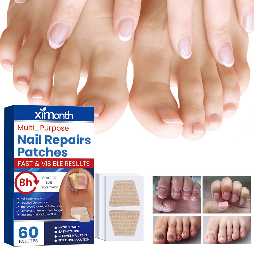 Ximonth Nail Care Stickers Soft Nail Thickening Type Bright Nail Groove Grey Nail Care Patch