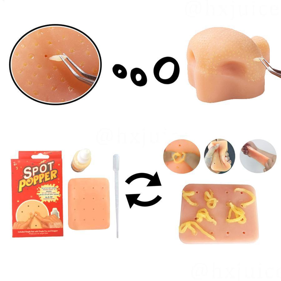 Skin Picking Pimple Fidget ของเล่นซิลิโคนบีบความเครียดบรรเทาของเล่นสมจริงสตรอเบอร์รี่จมูก Pimple Popping จําลอง fotth