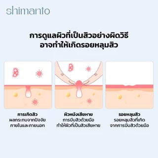 Shimanto แท้ แผ่นแปะสิว กันน้ำกันเหงื่อ ไม่มันเงา ผิวแพ้ง่ายใช้ได้ รักษาและปกปิดสิวอักเสบ
