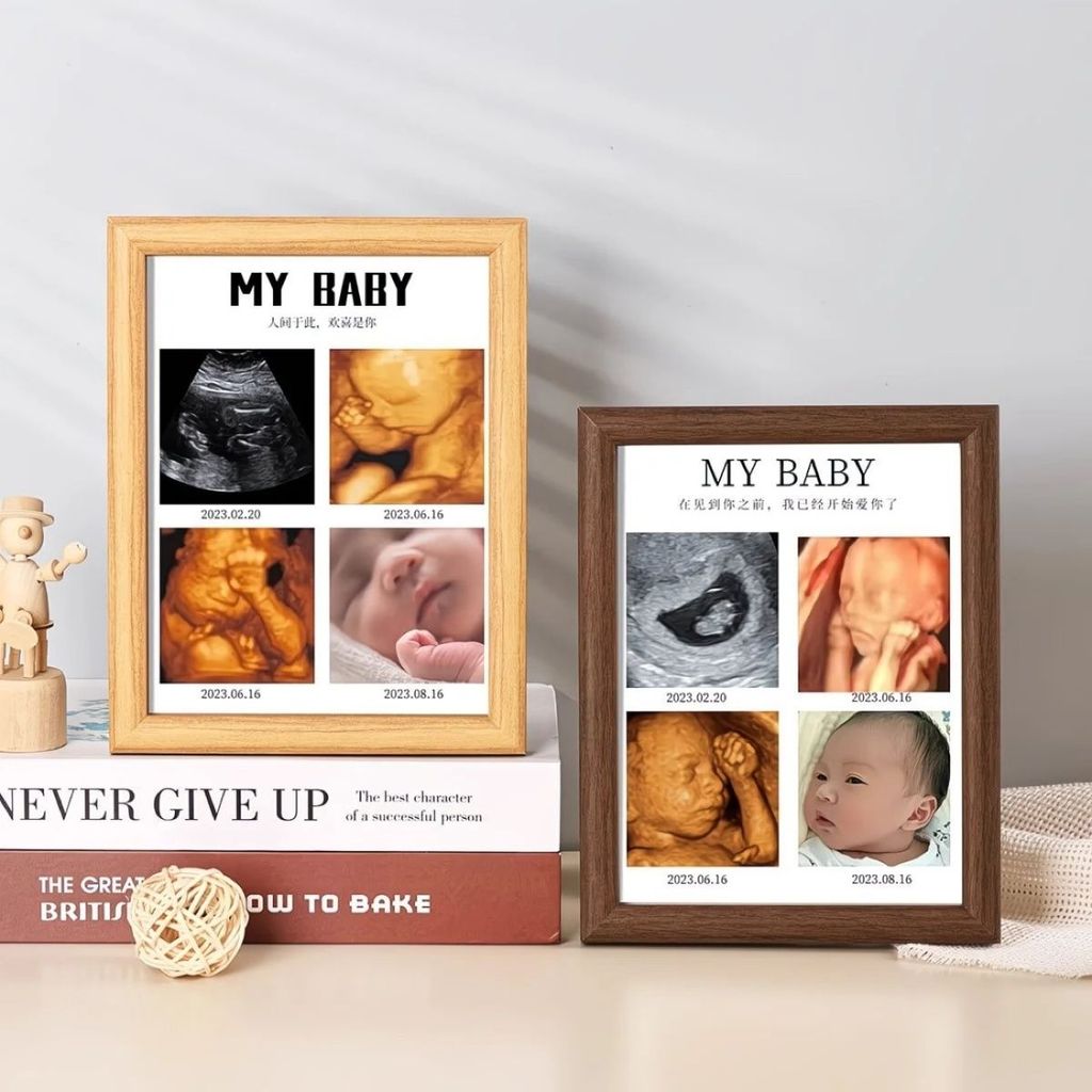 !Yy อัลตราซาวนด์แฟรงกรอบ diy foto foto foto fotojang Haxan Fland Gover Literation กรอบรูปภาพสี่มิติ 