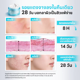PAPA FEEL 5X Ceramide Barrier ครีมกู้ผิวเร่งด่วน ลดสิวและอาการระคายเคือง | บำรุงผิวให้ชุ่มชื้นอย่างล้ำลึก | เหมาะสำหรับผิวแพ้ง่าย Moisturizing Cream 30g