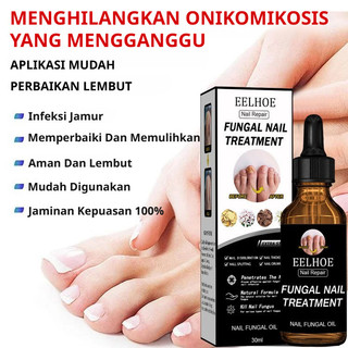 [Perawatan Cepat Untuk Onikomikosis] Solusi Perbaikan Kuku | Solusi Nutrisi Kuku | Formula Herbal Alami | Memperkuat Akar Kuku | Menebalkan Kuku | Meningkatkan Kilau Kuku | Mengobati Onikomikosis | Memperbaiki Kerusakan Kuku | Perawatan Kuku