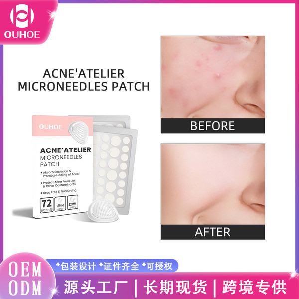 แผ่นแปะสิว แผ่นแปะสิว bk อุ๊ย แผ่นแปะสิวใบหน้าสีแดงซ่อมแซมสิวสิวทําความสะอาดรูขุมขนให้ความชุ่มชื้นผิ