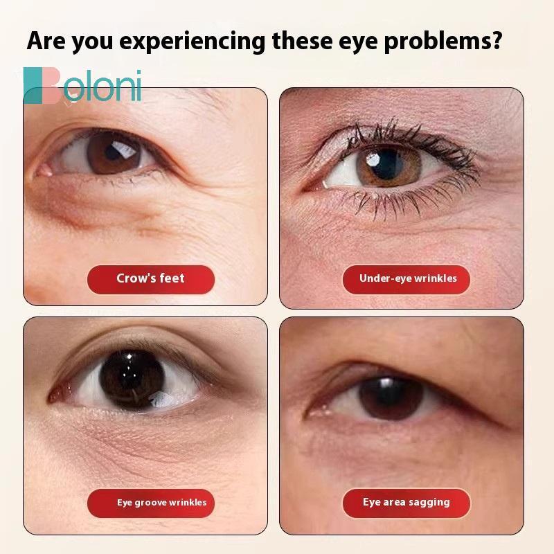 [โบโลนี] ไม้นวดตาดอกบัวทองเหลืองเครื่องมือกัวซาใบหน้าเครื่องมือมือถือเพื่อการผ่อนคลายตาและการนวดกดจุดเส้นเมอริเดียนใหม่ - รูปที่ 4