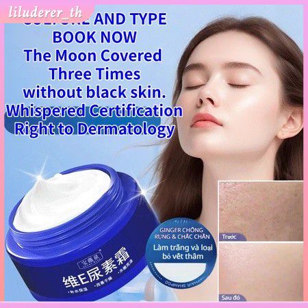 【ซื้อ 1 แถม 1】baoweiquan Krim Urea Berwarna Ringan Vitamin E Urea Cream Chicken Skin Body Lotion Ure