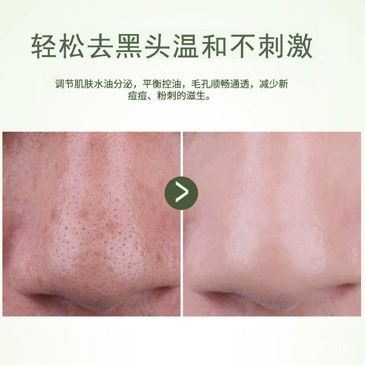 Blackhead Removal สิว Softening ส่งออก Liquid สําหรับ Essence Hair Follicles Purifying Cuticles ทําค