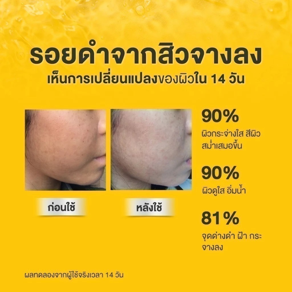 (1ซอง) สกินซิสต้าร์ แบบซอง Skinsista V Block V Acne Clear Vit C Booster&Cream - รูปที่ 7