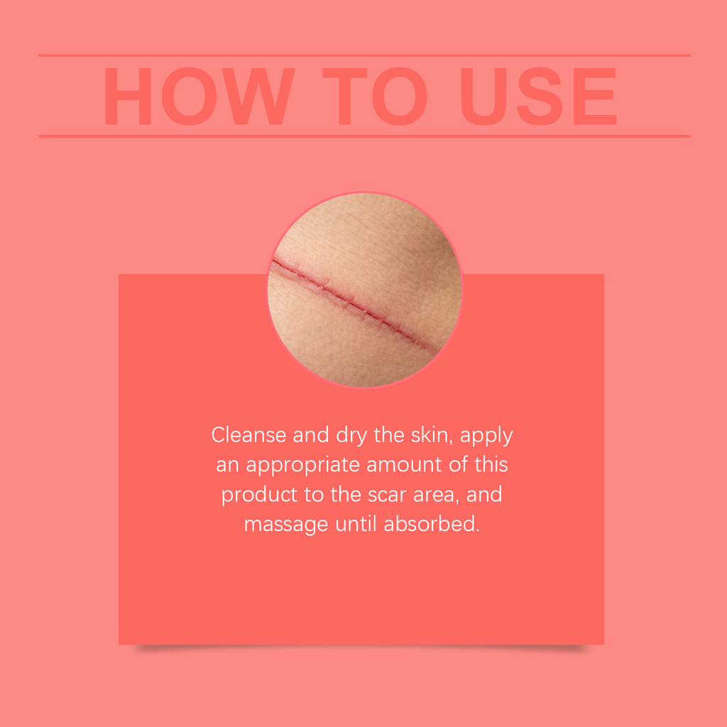 ครีมบํารุงผิว 30g| Even Skin Tone | เหมาะสําหรับทุกสภาพผิว | เนื้อละเอียด การดูดซึมอย่างรวดเร็ว - รูปที่ 7