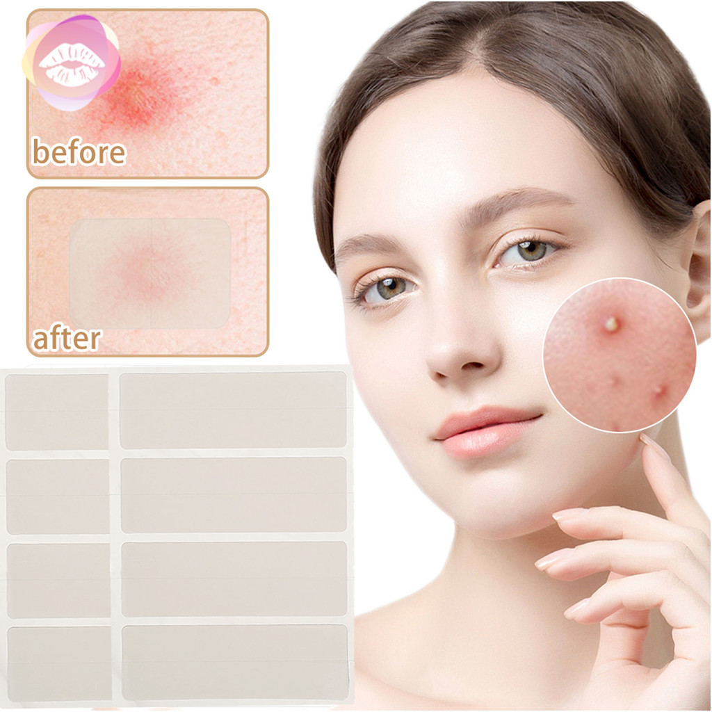 [ความงาม]-T-Zone Acne Cover Patch สําหรับแต่งหน้า | ไฮโดรเจล สติ๊กเกอร์สิวใส 4 ขนาด, กันน้ําและระบาย