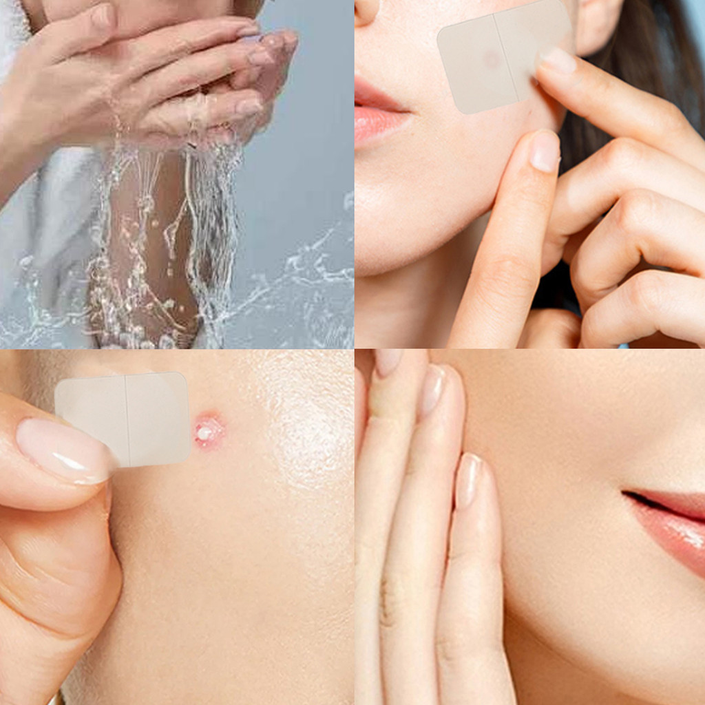 2/4 ชิ้นกันน้ํา Face Removal Pimple Beauty Paster - สีโปร่งใสสติกเกอร์ใบหน้าสาว - ขนาดที่สมบูรณ์แบบ 