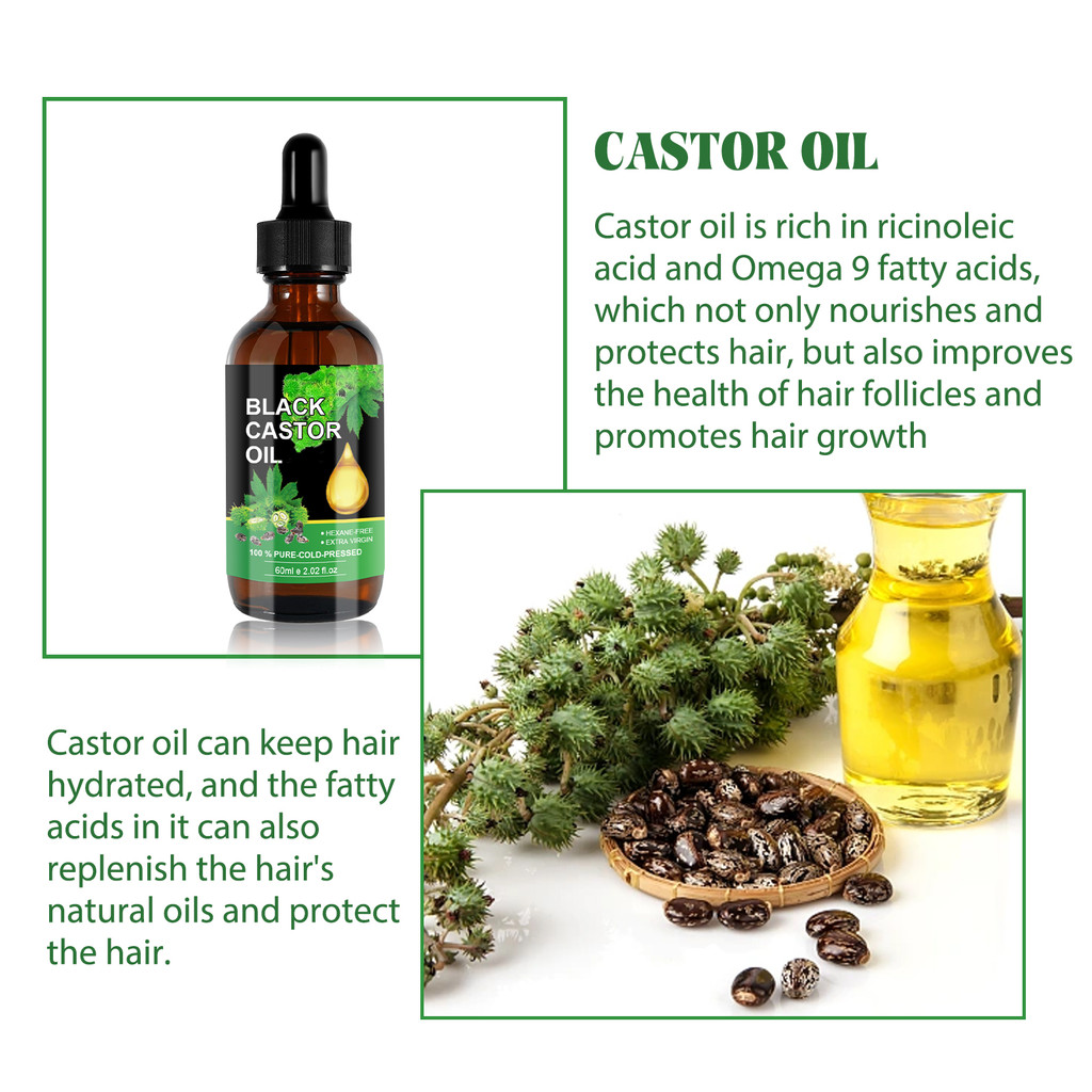 OUHOE Castor Oil Density Hair Lotion บํารุงรากผมผมร่วงนุ่มป้องกันความหนาแน่น Hair Lotion