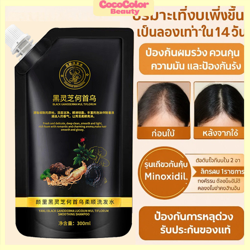 อัพเกรดไแชมพูป้องกันผมร่วงโสมและโชวู สมุนไพรสด7ชนิด ลดผมขาดหลุดร่วง ถนอมเส้นผม บำรุงผม กระตุ้นการงอกใหม่ Hair แชมพูบำรุง