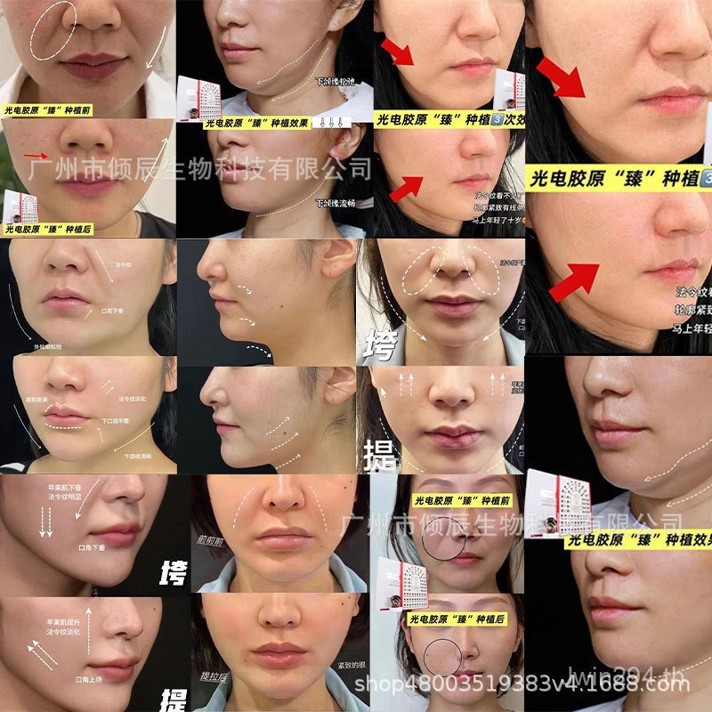 Anti-Wrinkle Firming Lifting Rejuvenating Essence Collagen Optoelectronics Beauty Salon ประเภทสามน้ํ