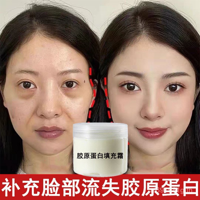 กระชับต่อต้านริ้วรอยครีมคอลลาเจนครีมกําจัดริ้วรอยบรรจุRe-Set Hydratingจมูกริ้วรอยหัวครีมริ้วP2NR