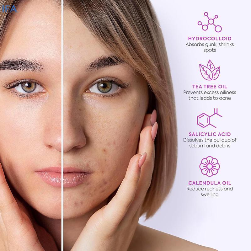 IFA 128 ชิ้น/เซ็ต Pimple Patch สิวที่มีสีสันที่มองไม่เห็น Skin Care สติกเกอร์คอนซีลเลอร์ Face Spot B