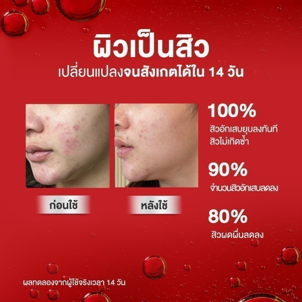 (1ซอง) สกินซิสต้าร์ แบบซอง Skinsista V Block V Acne Clear Vit C Booster&Cream - รูปที่ 5