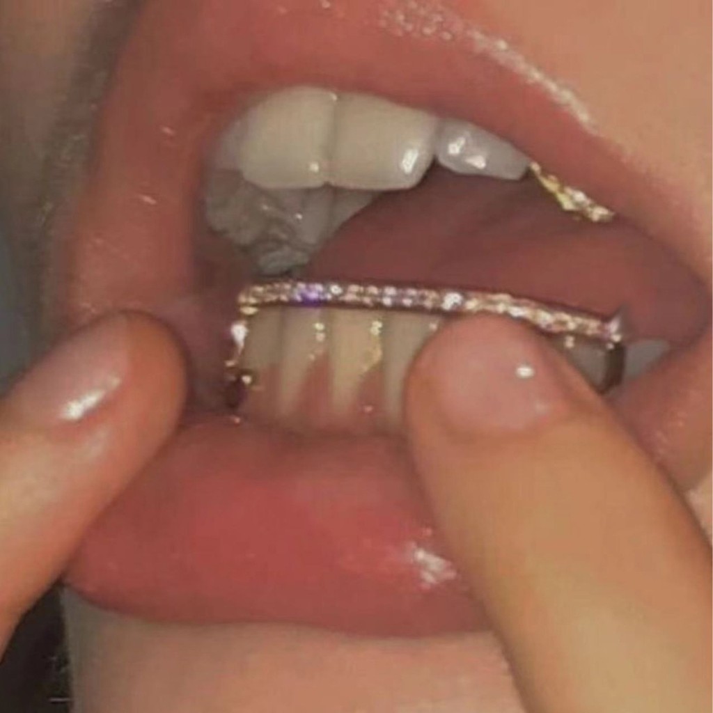 【ส่งไว】Teeth Grillz เพชรแต่งฟัน สไตล์อเมริกัน วัสดุทนทาน ปลอดภัย ใช้งานง่าย มีกาวแถมให้