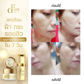 (ของแท้)ครีมแฟรี่โกลด์ ครีมเข้มข้น (มีให้เลือก4สูตร )