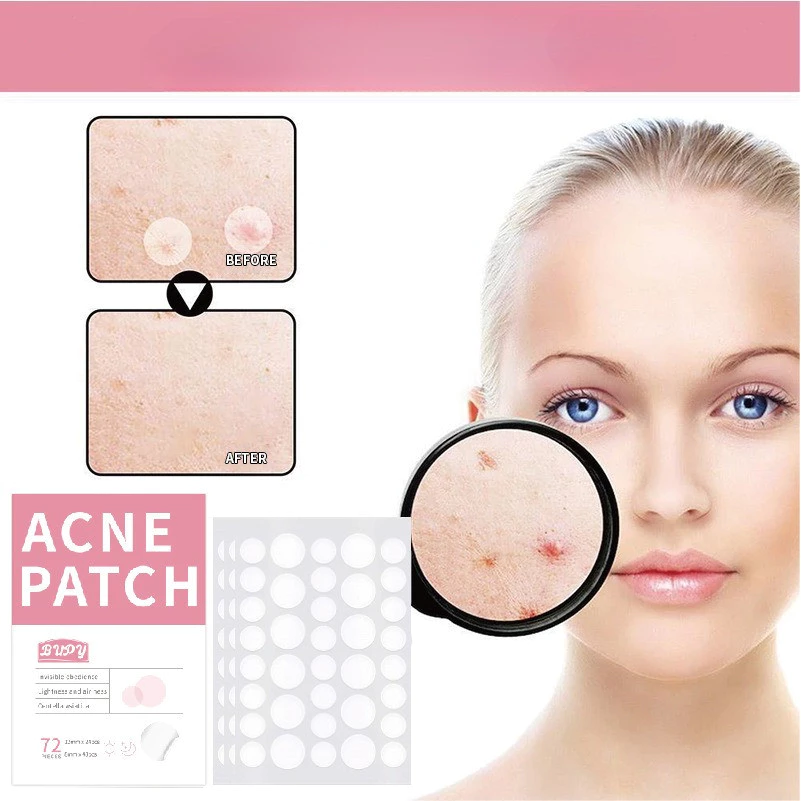 แผ่นแปะสิวที่มองไม่เห็น – สติ๊กเกอร์กําจัดสิวสําหรับซ่อมแซมสิวและการรักษารอยแผลเป็น