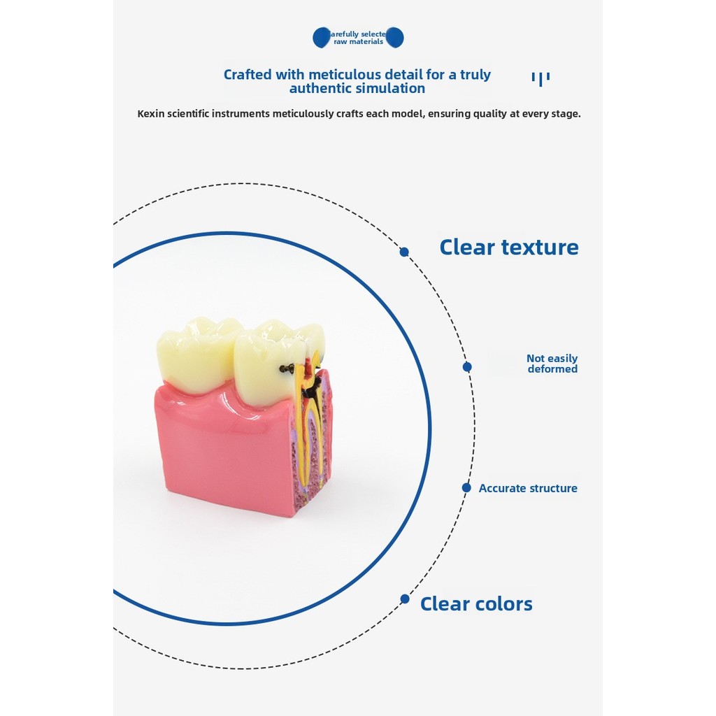 Six Times Caries Comparison Model Oral Tooth Model Oral Teaching Cavities Sectional Model อุปกรณ์ทันตกรรม
