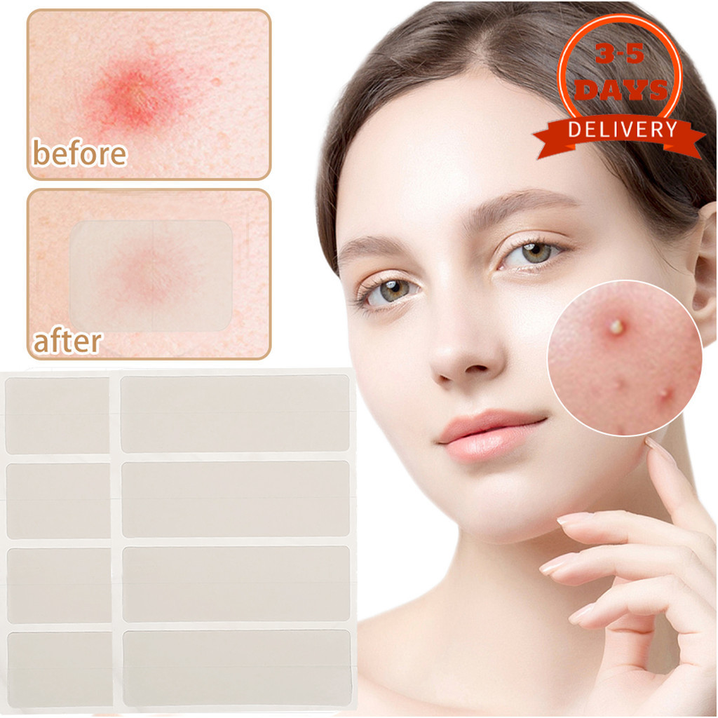 [3-5 วันมาถึง]-T-Zone Acne Cover Patch สําหรับแต่งหน้า | ไฮโดรเจล สติ๊กเกอร์สิวใส 4 ขนาด, กันน้ําและ